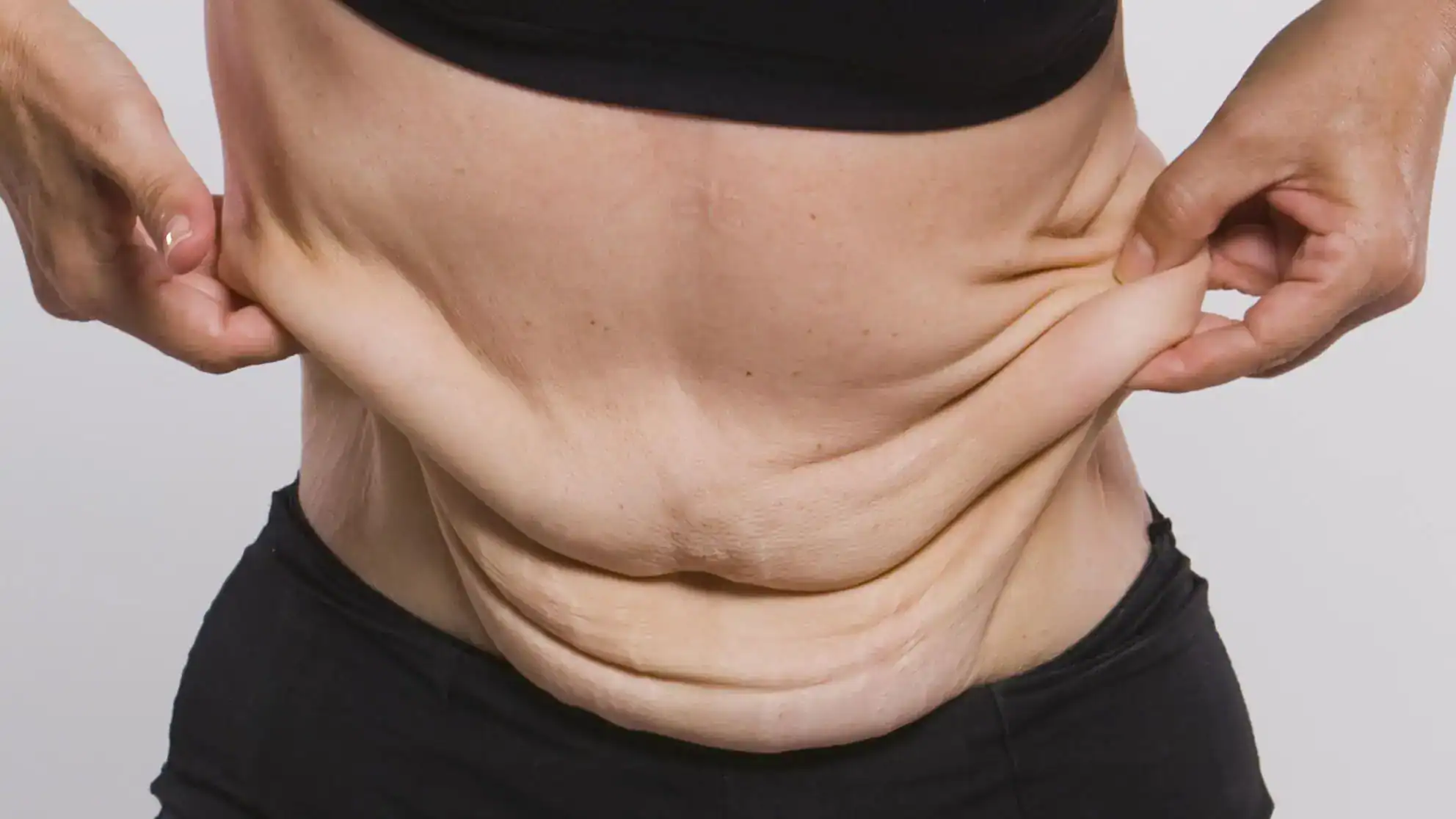 FDL Tummy Tuck 36 gevsek karin derisi