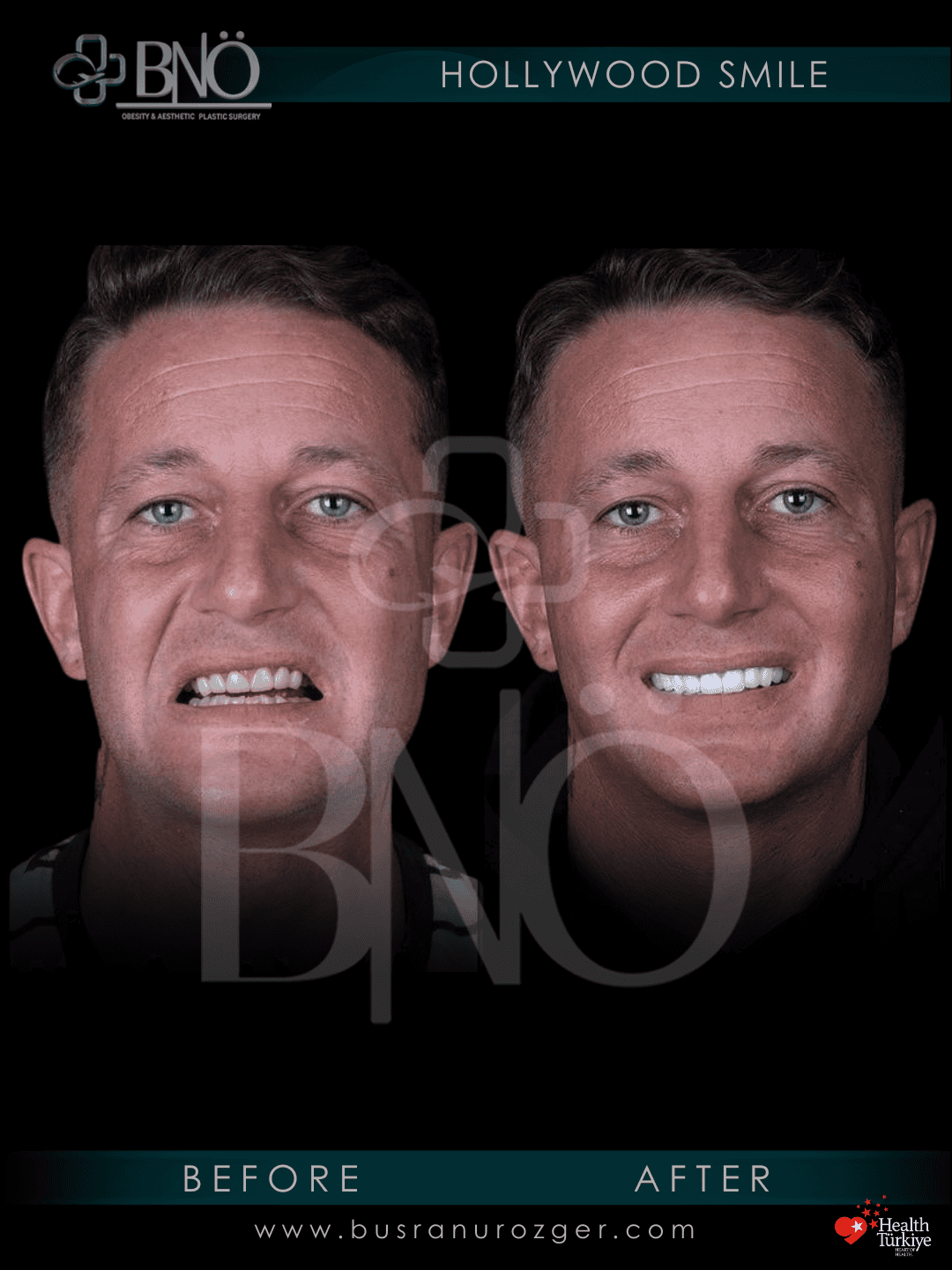 Hollywood Smile 27 234