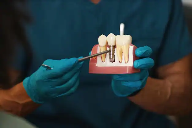 Dental Implants 34 Dental Implants in turkey